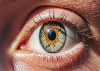 Eye color and swelling indicate health condition, Tridosha balance is the biggest reason.