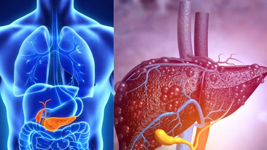 Fatty Liver Disease: These 8 habits of yours can make your liver sick, cases are increasing rapidly.