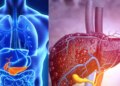 Fatty Liver Disease: These 8 habits of yours can make your liver sick, cases are increasing rapidly.
