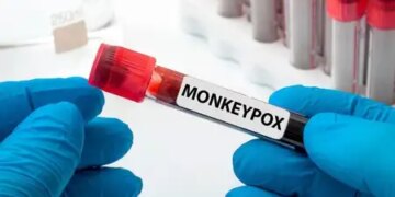 First MPOX case of 2026 in Karachi, infection confirmed in a person returning from abroad