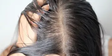 Hair Care Tips: What to eat for strong and thick hair? Nutritionist told the right diet and necessary changes