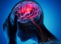 Health Alert: Increasing cases of brain stroke under the age of 40, doctors told three main reasons