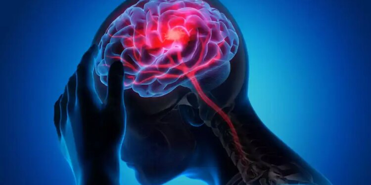 Health Alert: Increasing cases of brain stroke under the age of 40, doctors told three main reasons