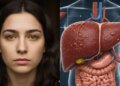 If these signs are visible in the eyes then be careful, these can be the initial symptoms of Liver Cancer.