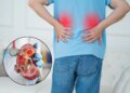 Kidney Disease Alert: Kidney checkup can be done at home, know the main symptoms and signs which can indicate problems.