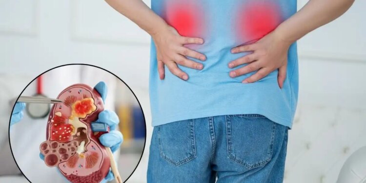 Kidney Disease Alert: Kidney checkup can be done at home, know the main symptoms and signs which can indicate problems.
