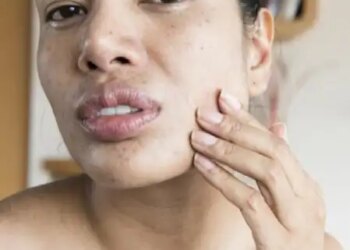 Skin is withering prematurely, incomplete sleep is the real cause of wrinkles