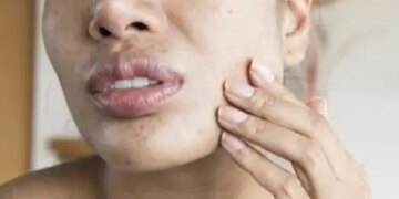 Skin is withering prematurely, incomplete sleep is the real cause of wrinkles