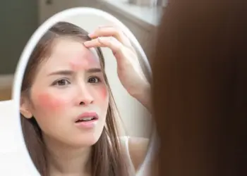 Sun's temperature is rising: Know easy and effective ways to protect your skin from burning in summer.