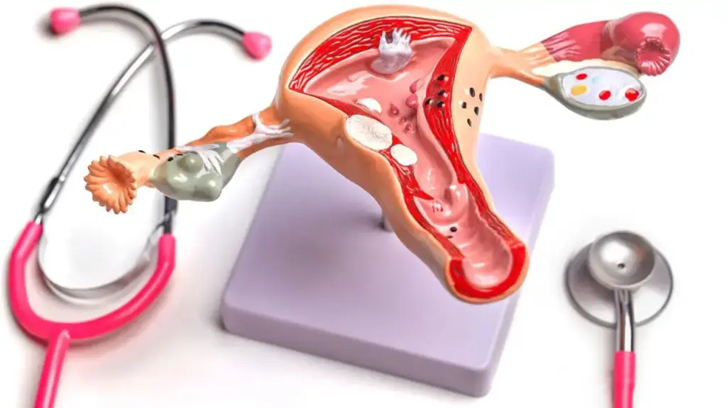 Uterus Cancer Alert: How to know whether there is cancer in the uterus or not? Know the initial symptoms and easy methods of identification