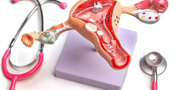 Uterus Cancer Alert: How to know whether there is cancer in the uterus or not? Know the initial symptoms and easy methods of identification