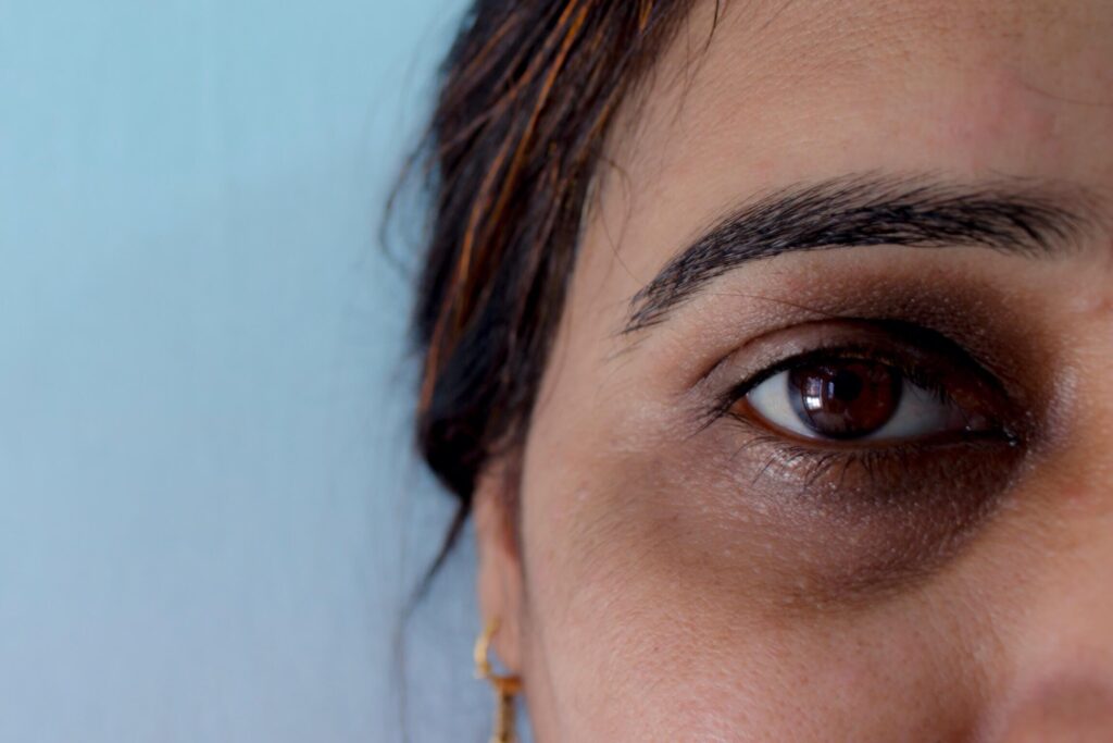 ≡ 7 Natural Ways to Get Rid of Dark Circles 》 Her Beauty