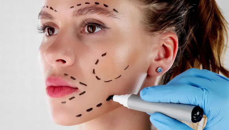 ≡ Biggest trends of face plastic surgery in 2025 - What is beneficial, what is risky and who has to be seen - why this? 》Her Beauty