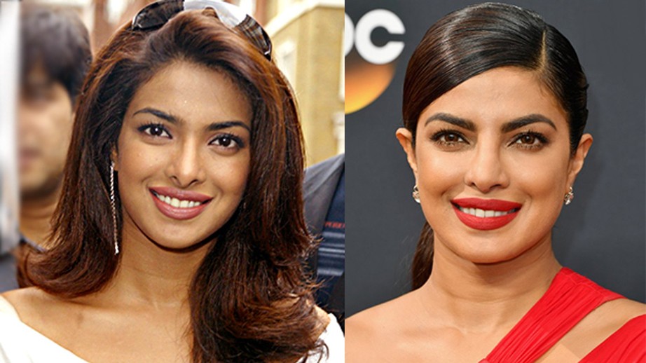 ≡ How plastic surgery changed the look of these actresses? 》Her Beauty