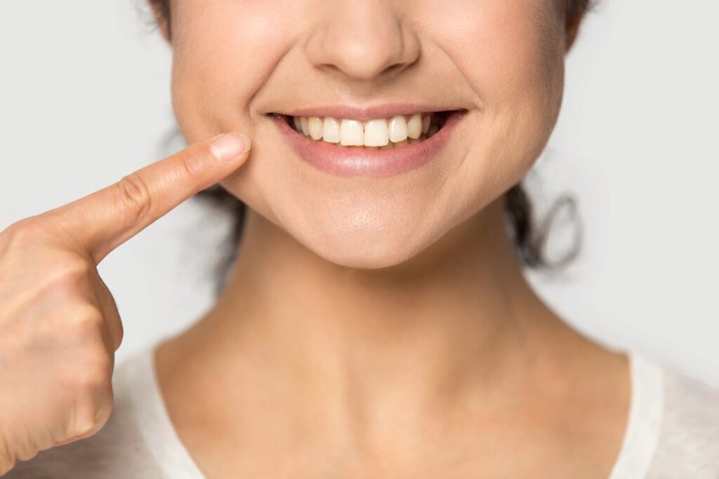 ≡ How to whiten your teeth naturally in 3 minutes at home? 》Her Beauty