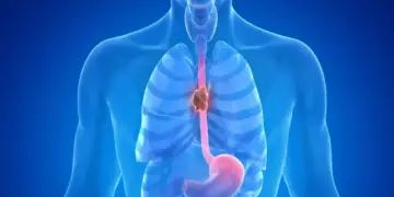 Persistent cough and throat problems can be a sign of esophageal cancer, do not ignore it.
