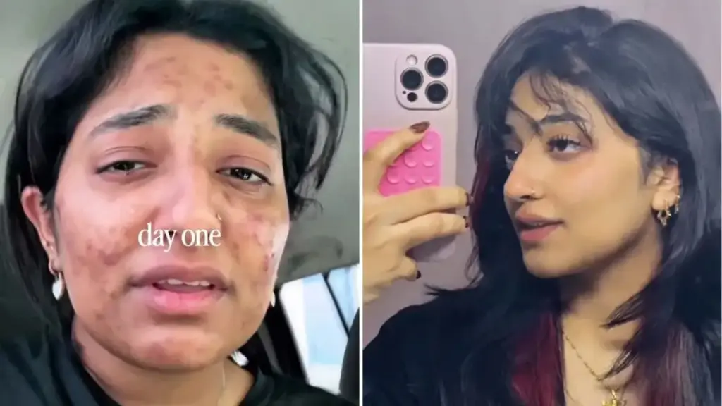 Skin changed with two easy changes: Video of 23 year old girl from Dubai goes viral