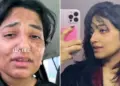 Skin changed with two easy changes: Video of 23 year old girl from Dubai goes viral
