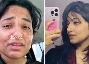 Skin changed with two easy changes: Video of 23 year old girl from Dubai goes viral