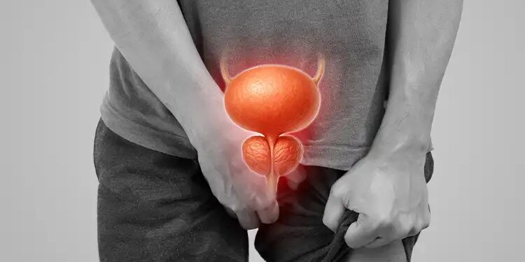 These 5 urinary problems can be a sign of serious disease, know the symptoms of prostate cancer