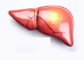 Too much sugar, fast food and oil are poison for the liver, take special care of these things