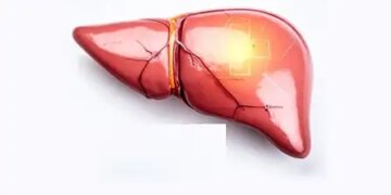 Too much sugar, fast food and oil are poison for the liver, take special care of these things
