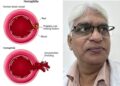 World Haemophilia Day: Management of bleeding is possible with Unani medicine – Dr. Liaquat Ali Mansoori