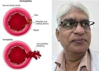 World Haemophilia Day: Management of bleeding is possible with Unani medicine – Dr. Liaquat Ali Mansoori