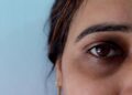 ≡ 7 Natural Ways to Get Rid of Dark Circles 》 Her Beauty