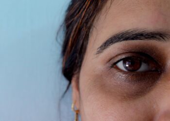 ≡ 7 Natural Ways to Get Rid of Dark Circles 》 Her Beauty