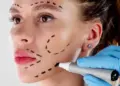 ≡ Biggest trends of face plastic surgery in 2025 - What is beneficial, what is risky and who has to be seen - why this? 》Her Beauty