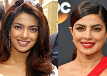 ≡ How plastic surgery changed the look of these actresses? 》Her Beauty