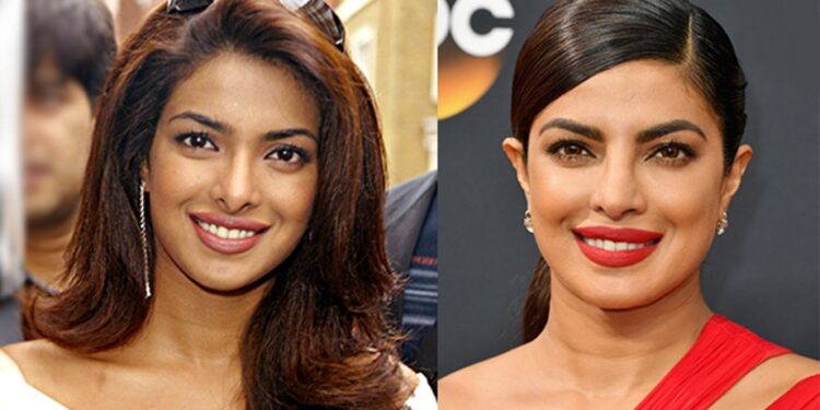≡ How plastic surgery changed the look of these actresses? 》Her Beauty