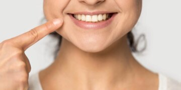 ≡ How to whiten your teeth naturally in 3 minutes at home? 》Her Beauty