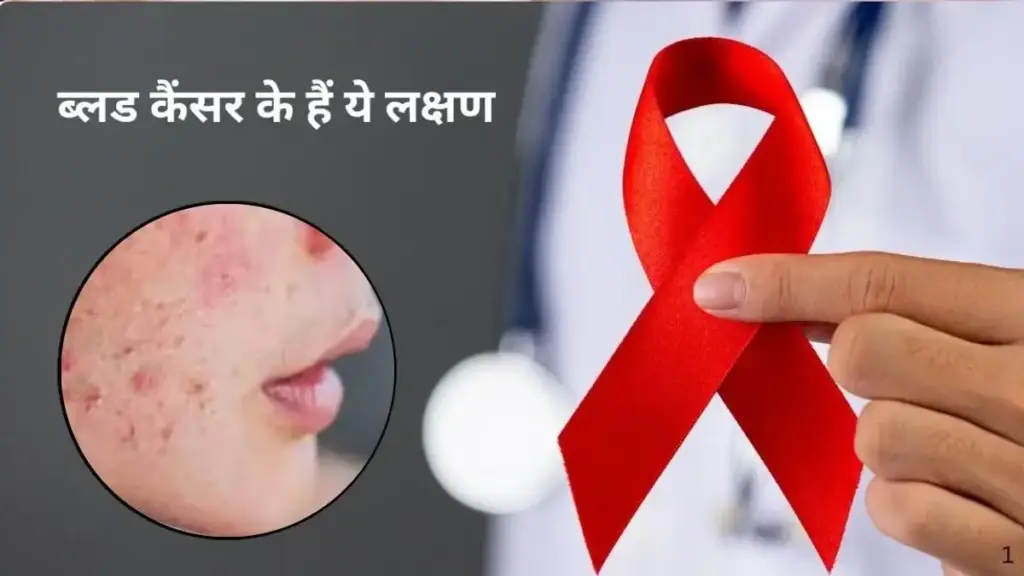 Blood Cancer Warning Signs: Do not ignore persistent rashes appearing on the skin, it can be a serious disease.