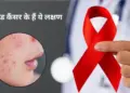 Blood Cancer Warning Signs: Do not ignore persistent rashes appearing on the skin, it can be a serious disease.