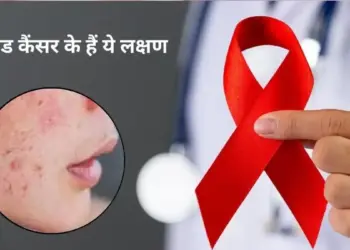 Blood Cancer Warning Signs: Do not ignore persistent rashes appearing on the skin, it can be a serious disease.