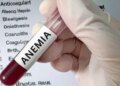Do not take persistent fatigue and weakness lightly, these can be signs of anemia.