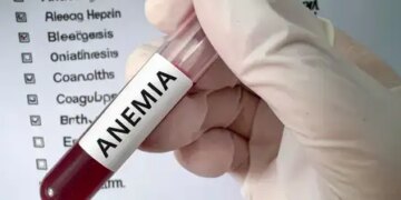 Do not take persistent fatigue and weakness lightly, these can be signs of anemia.