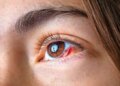 Eye pain or blurred vision can be a sign of serious eye cancer, ignoring these symptoms can be costly.