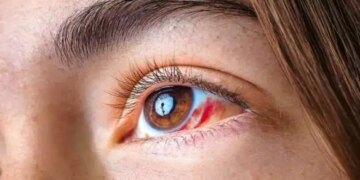 Eye pain or blurred vision can be a sign of serious eye cancer, ignoring these symptoms can be costly.