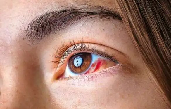 Eye pain or blurred vision can be a sign of serious eye cancer, ignoring these symptoms can be costly.