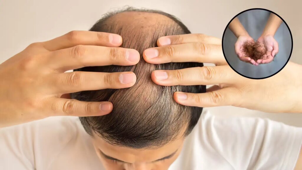 Hair Fall Remedy: Are you troubled by hair fall and baldness? Celebrity hair stylist told the special recipe of onion-garlic and mustard oil