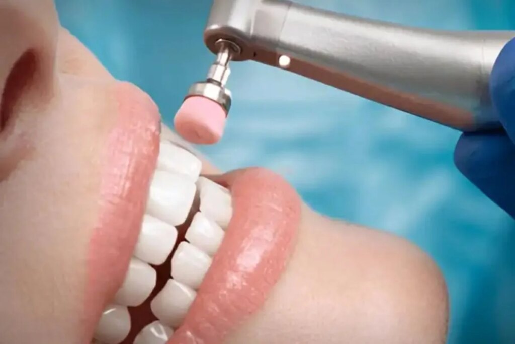 Make a career in Dental Hygienist: Great opportunity amidst increasing demand
