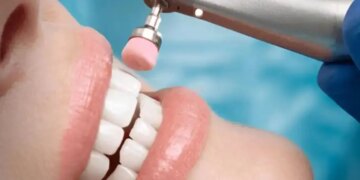 Make a career in Dental Hygienist: Great opportunity amidst increasing demand
