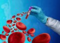 Now a blood test will reveal the risk of heart disease 15 years in advance.
