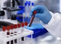 WHO declares Ebola a global health emergency, Karnataka on high alert
