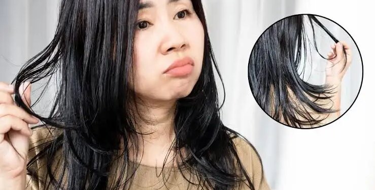 Do hair and skin problems increase during the rainy season? Know the effective hair and skin care tips given by experts