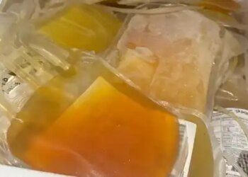 Gujarat: Adulterated plasma seized, declared 'not fit for human use'; Investigation extended to blood banks of Maharashtra