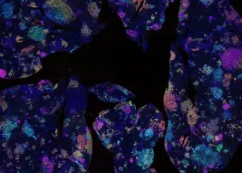 Lung cancer will be detected 5 years before blood test, big revelation in research